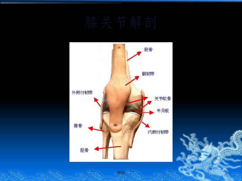 膝骨性关节炎课件.ppt_第3页