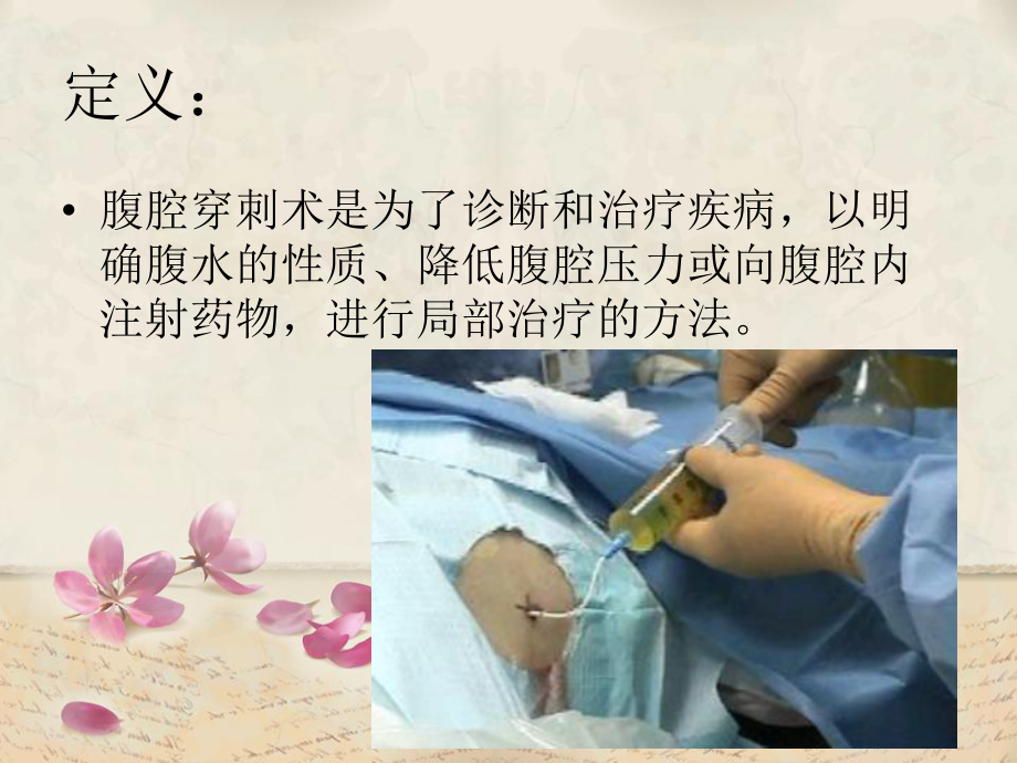 腹腔穿刺术及护理课件.ppt_第2页