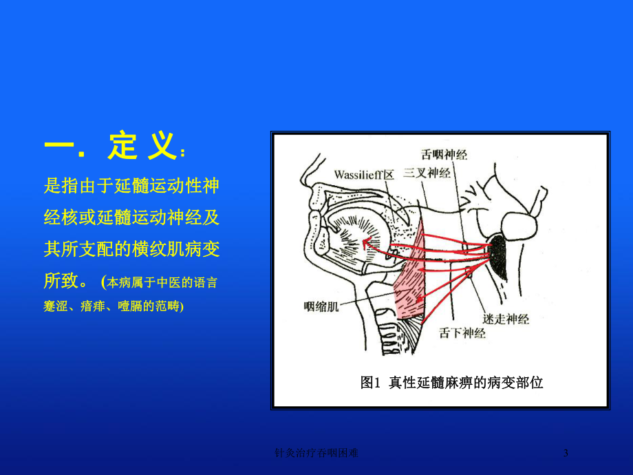 针灸治疗吞咽困难培训课件.ppt_第3页