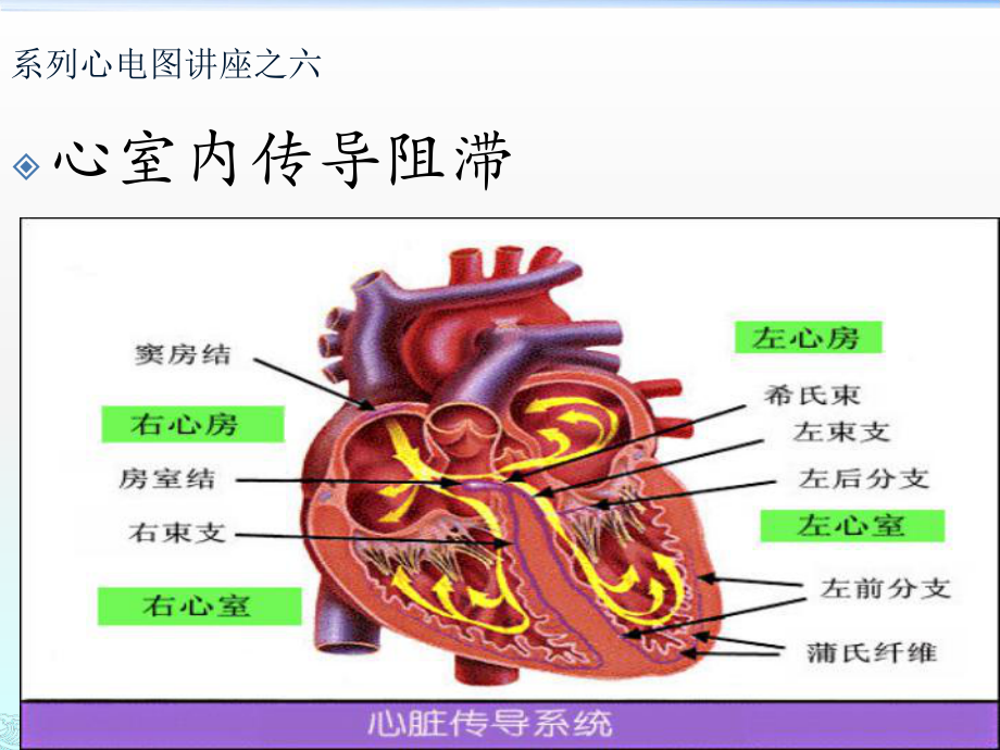 心室内传导阻滞课件.ppt_第1页