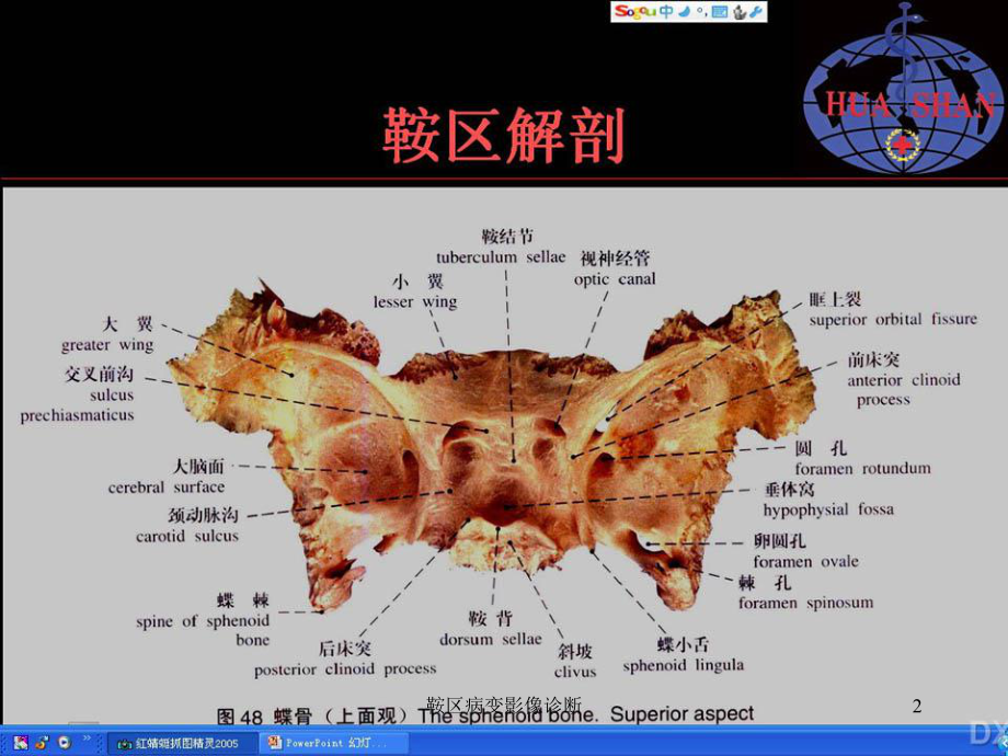 鞍区病变影像诊断课件.ppt_第2页