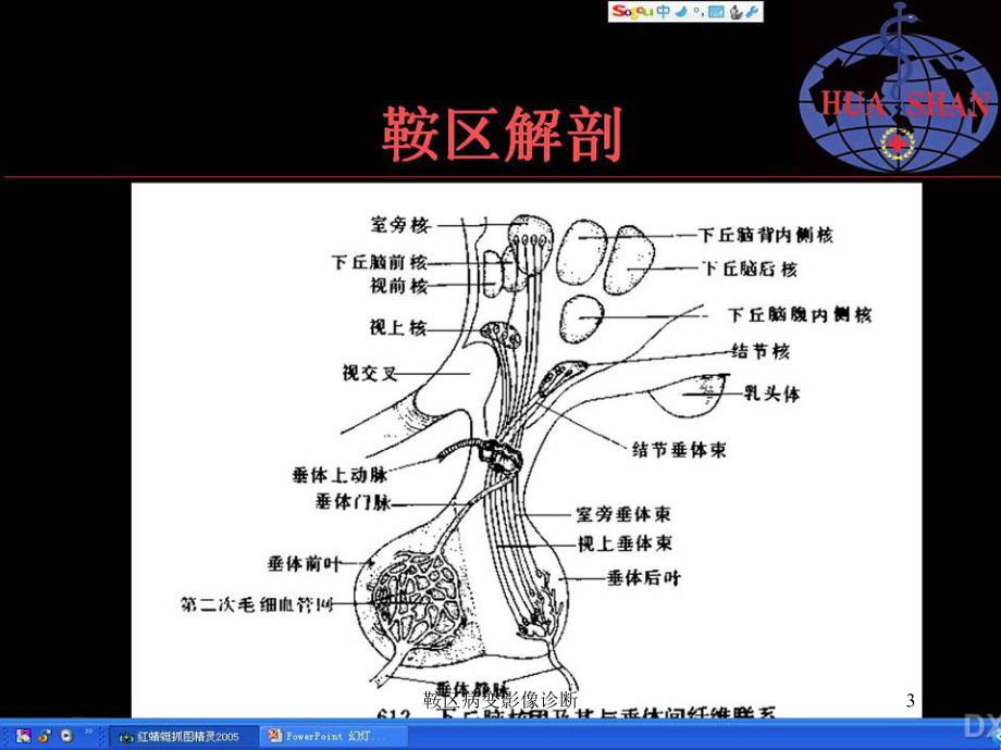 鞍区病变影像诊断课件.ppt_第3页