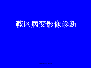 鞍区病变影像诊断课件.ppt