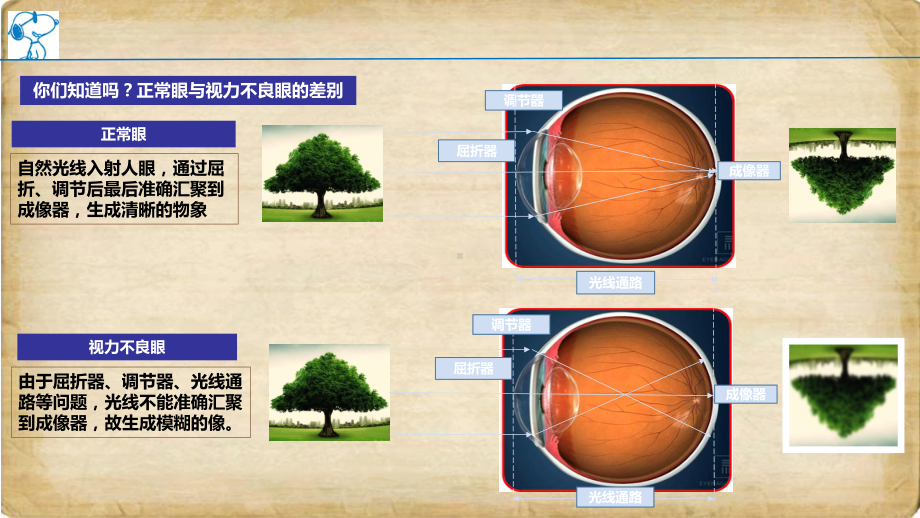 青少年近视眼的形成与发展上传课件.ppt_第3页