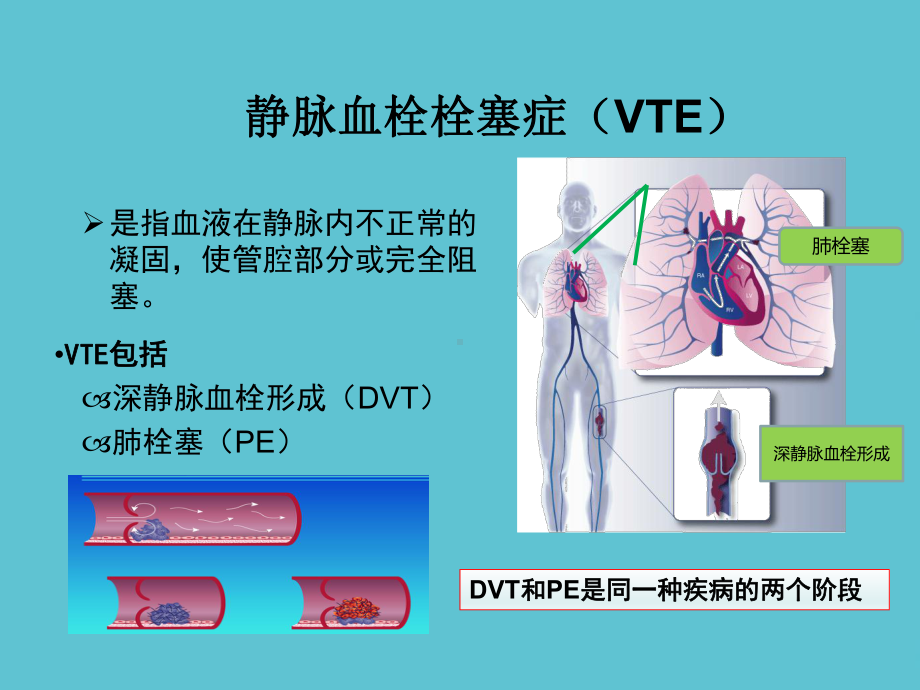 静脉血的预防及护理课件.ppt_第3页