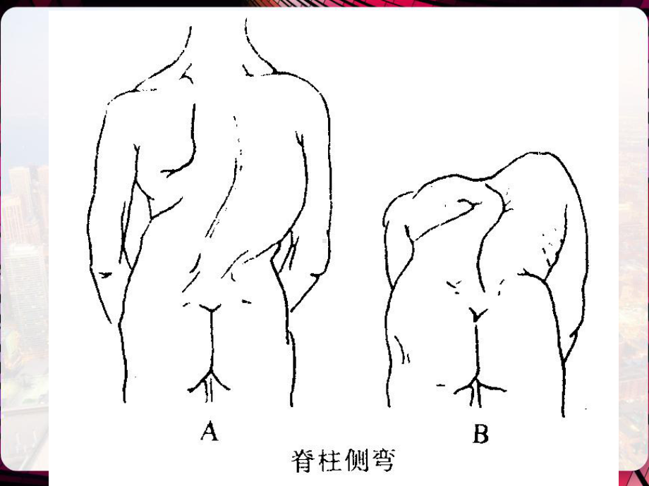 脊柱四肢及神经系统-课件.pptx_第3页