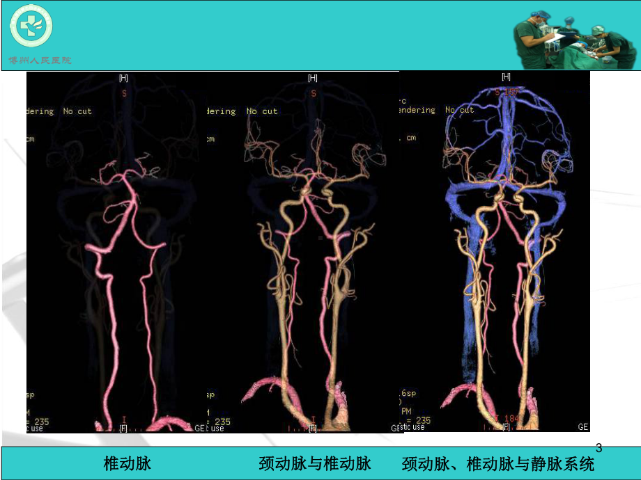 脑动脉解剖与CT重建D参考课件.ppt_第3页