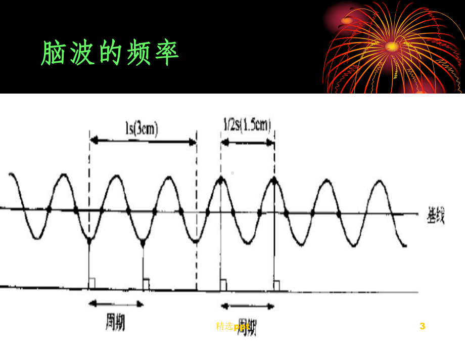 脑电图基本入门课件.ppt_第3页