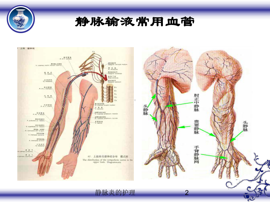 静脉炎的护理培训课件.ppt_第2页