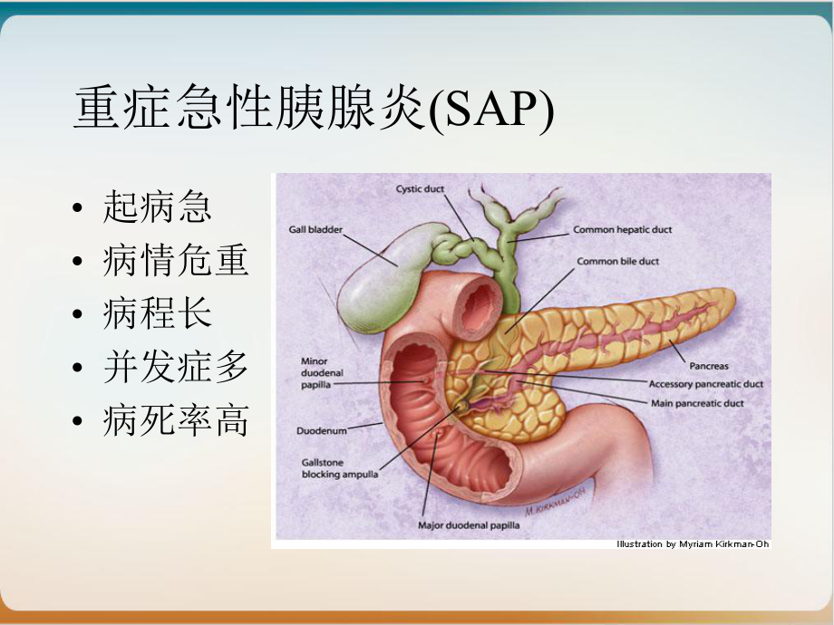 重症急性胰腺炎的营养策略培训课程课件.ppt_第3页