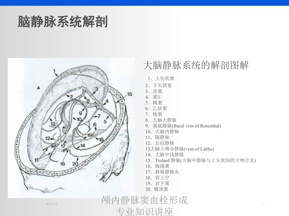 颅内静脉窦血栓形成专业知识讲座培训课件.ppt_第3页