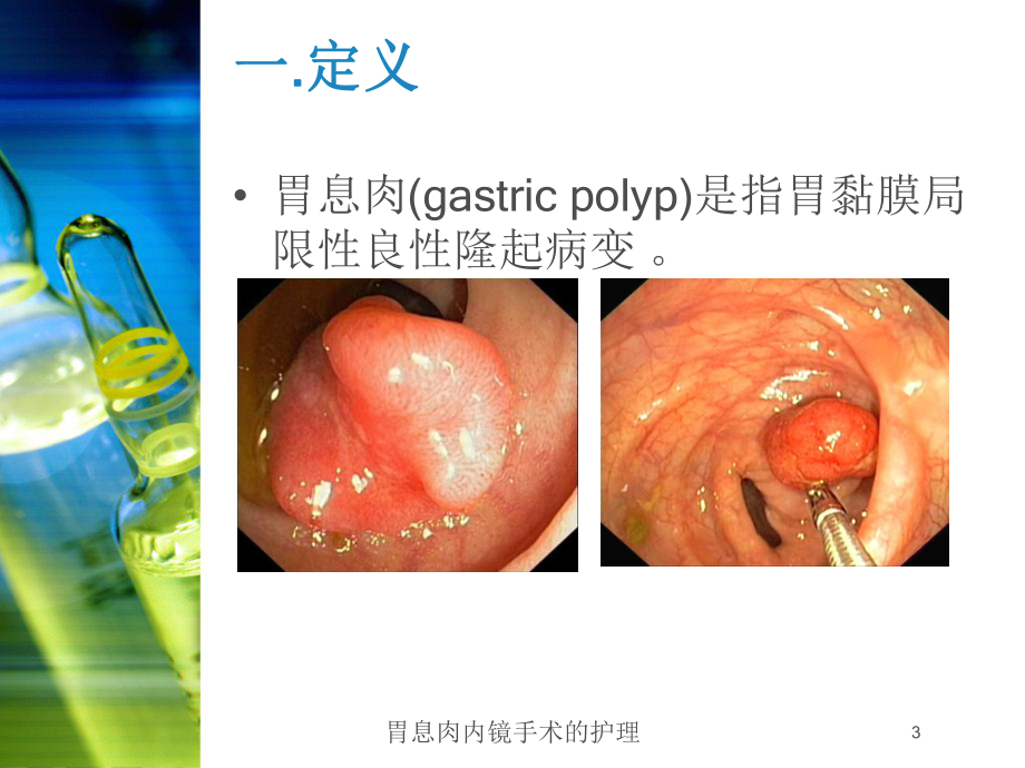 胃息肉内镜手术的护理培训课件.ppt_第3页