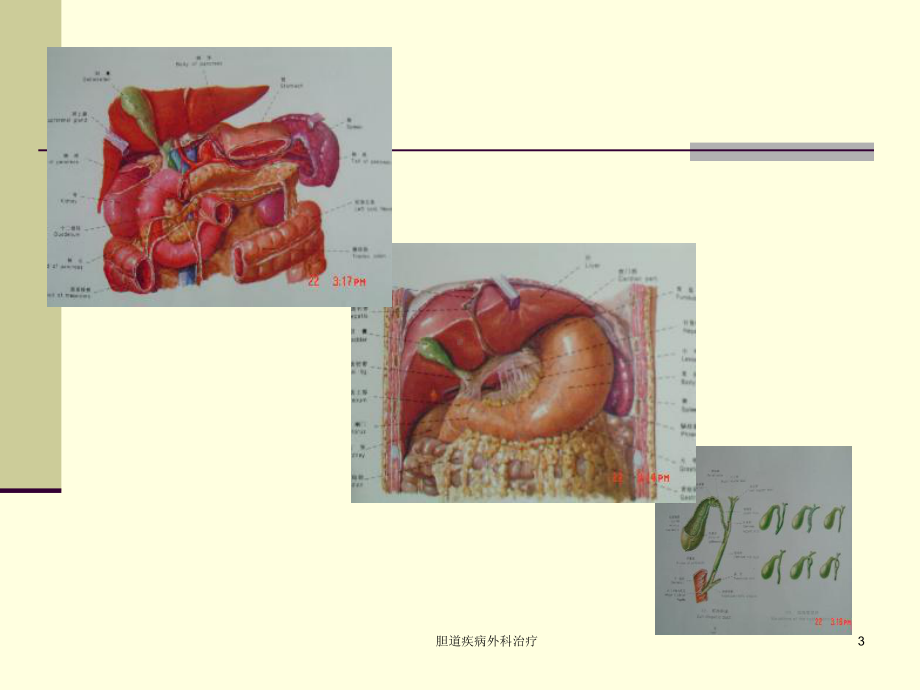 胆道疾病外科治疗课件.ppt_第3页