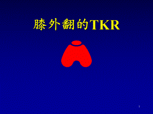 膝外翻畸形的TKR(新)学习课件.ppt