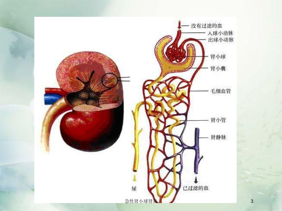 急性肾小球肾炎培训课件1.ppt_第3页