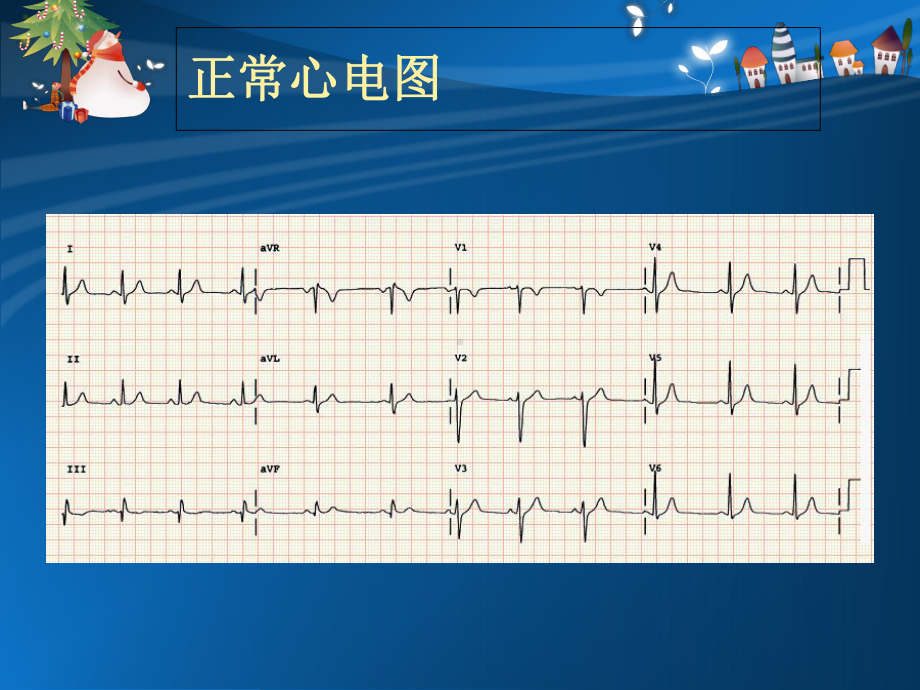 心电监护及除颤概要课件.ppt_第3页