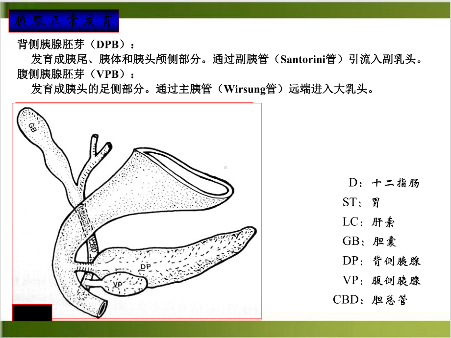 胰腺解剖变异与相关疾病示范课件.ppt_第3页