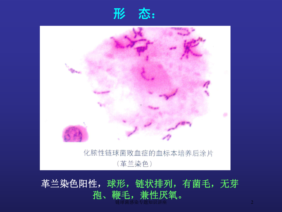 链球菌感染专题知识讲座培训课件.ppt_第2页