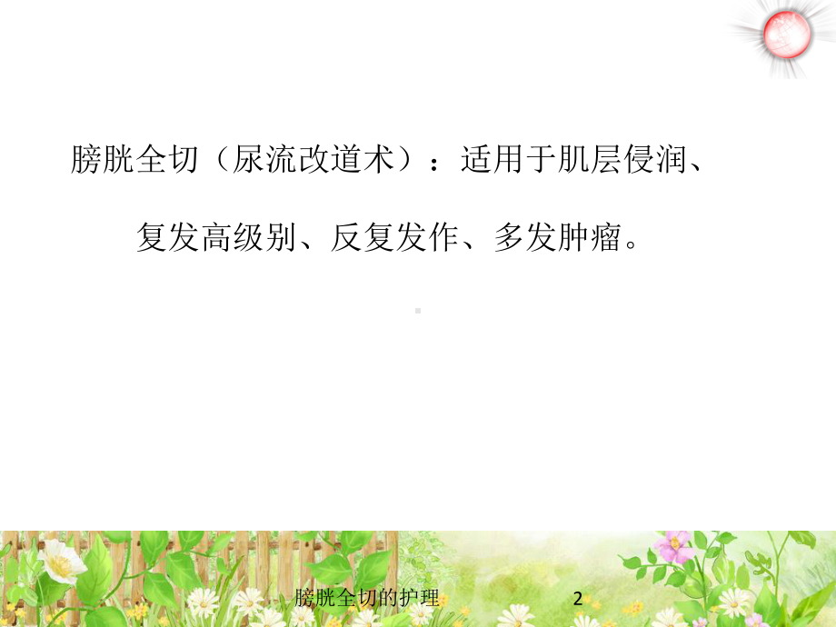 膀胱全切的护理培训课件.ppt_第2页