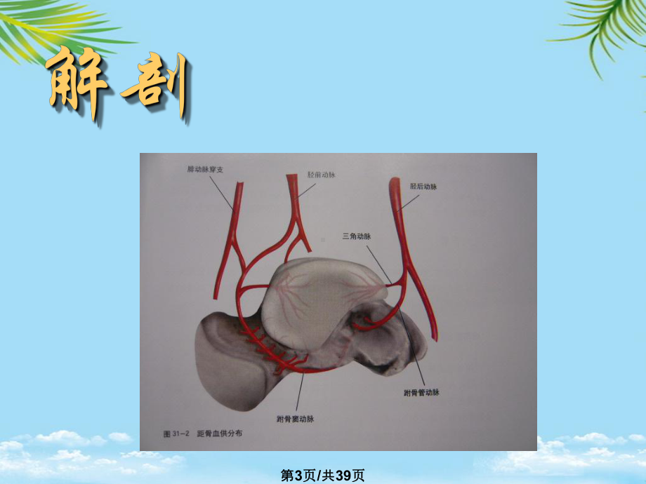 距骨骨折全面版课件.pptx_第3页