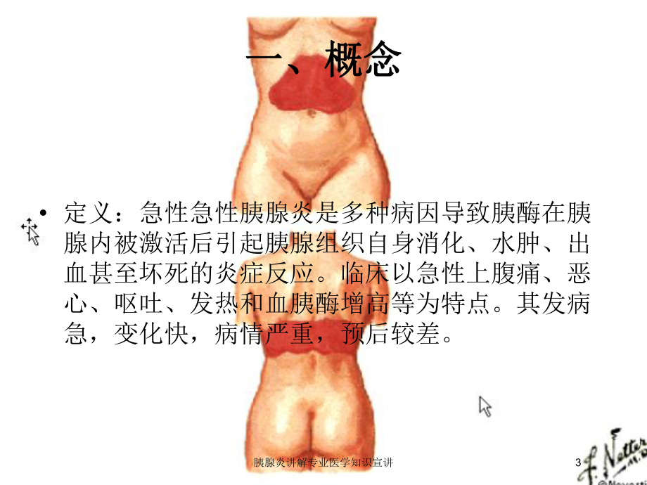 胰腺炎讲解专业医学知识宣讲培训课件.ppt_第3页