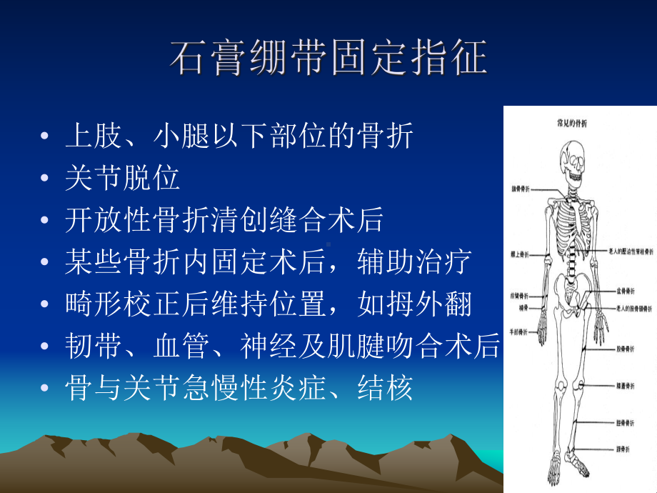 石膏及夹板固定技术课件.ppt_第3页