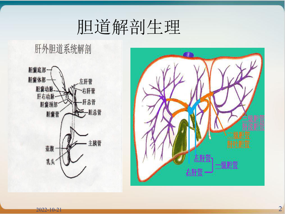 胆囊结石伴胆囊炎课件.ppt_第2页