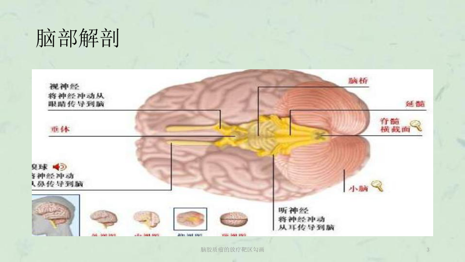 脑胶质瘤的放疗靶区勾画课件.ppt_第3页