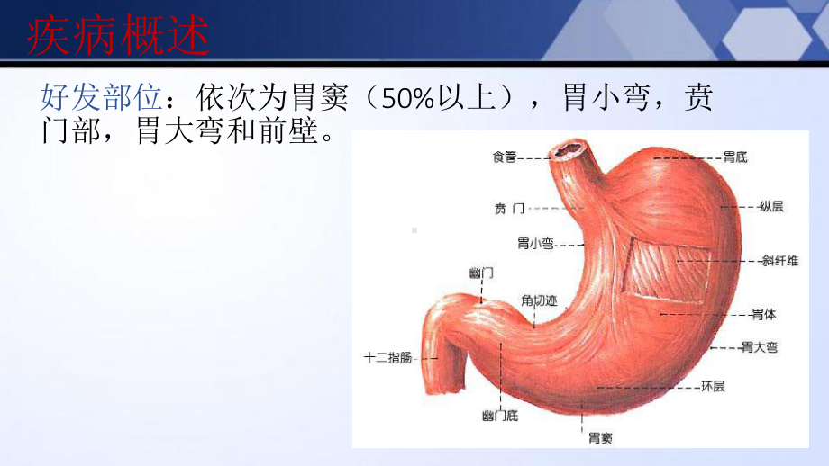 胃癌术后的医疗护理培训课件.ppt_第3页