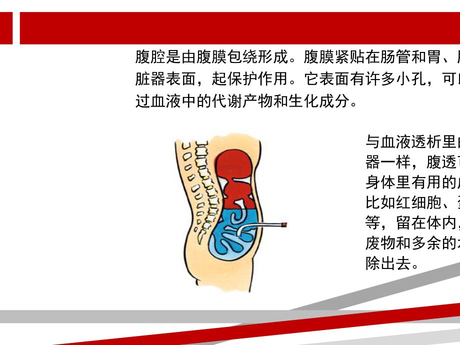 腹膜透析术前术后护理课件.ppt_第3页