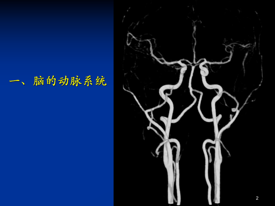 脑血管解剖专业知识培训课件.ppt_第2页