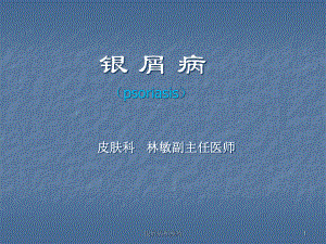 银屑病和痤疮课件.ppt