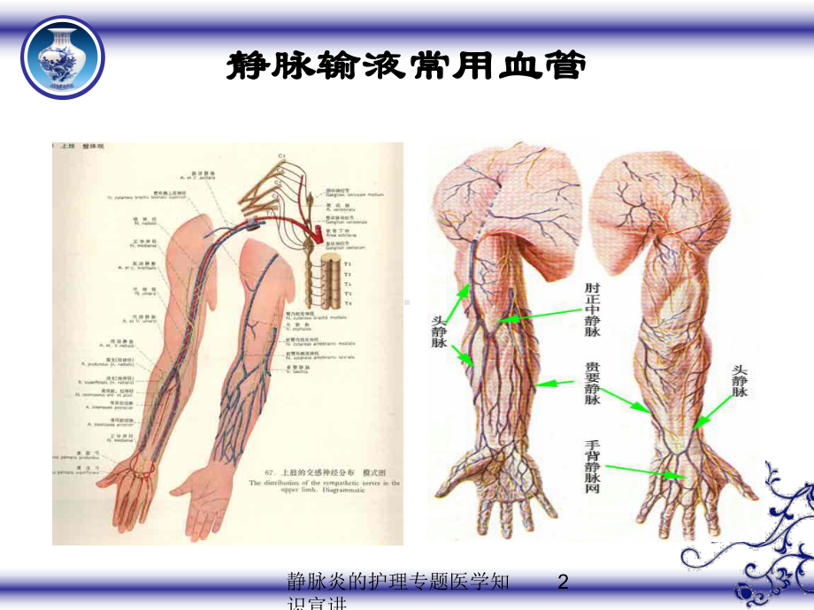 静脉炎的护理专题医学知识宣讲培训课件.ppt_第2页