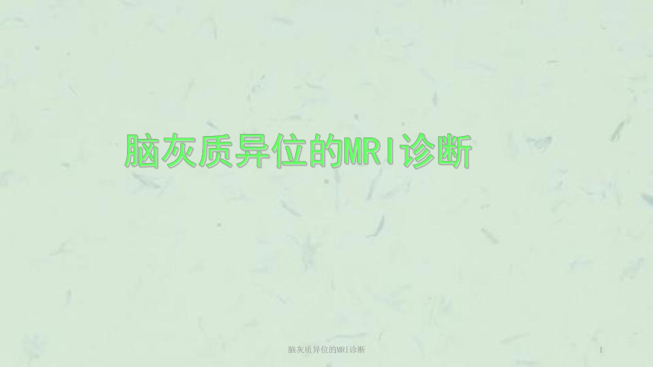 脑灰质异位的MRI诊断课件.ppt_第1页