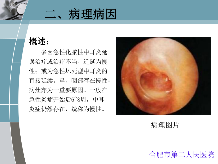 慢性化脓性中耳炎qq系列课件.ppt_第3页