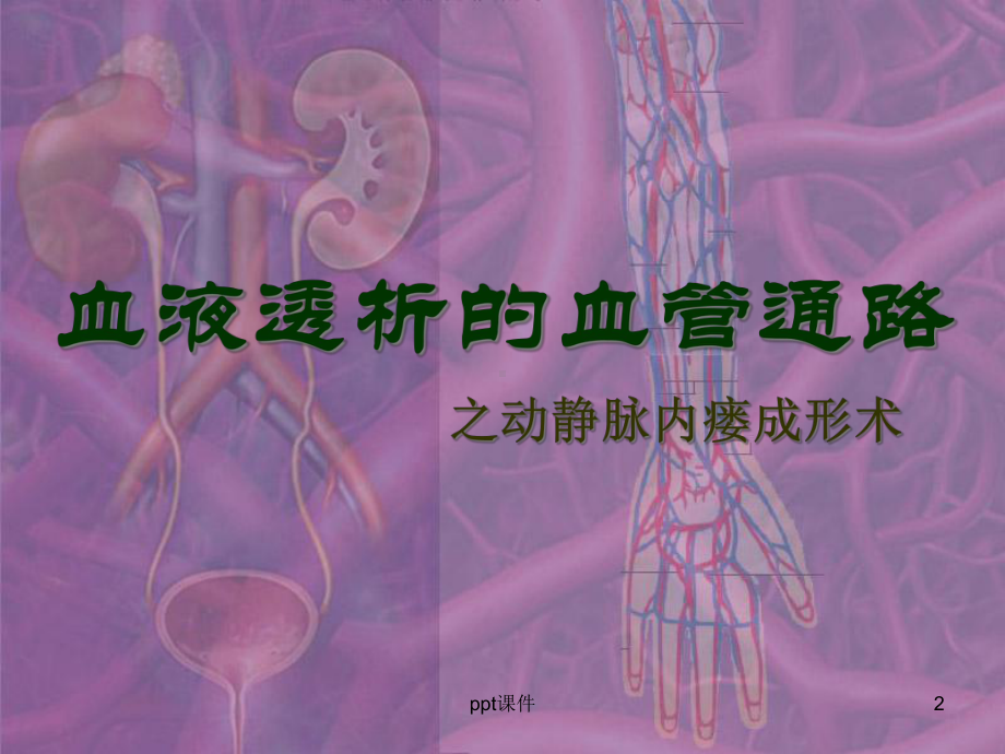 血液透析的血管通路-课件.ppt_第2页