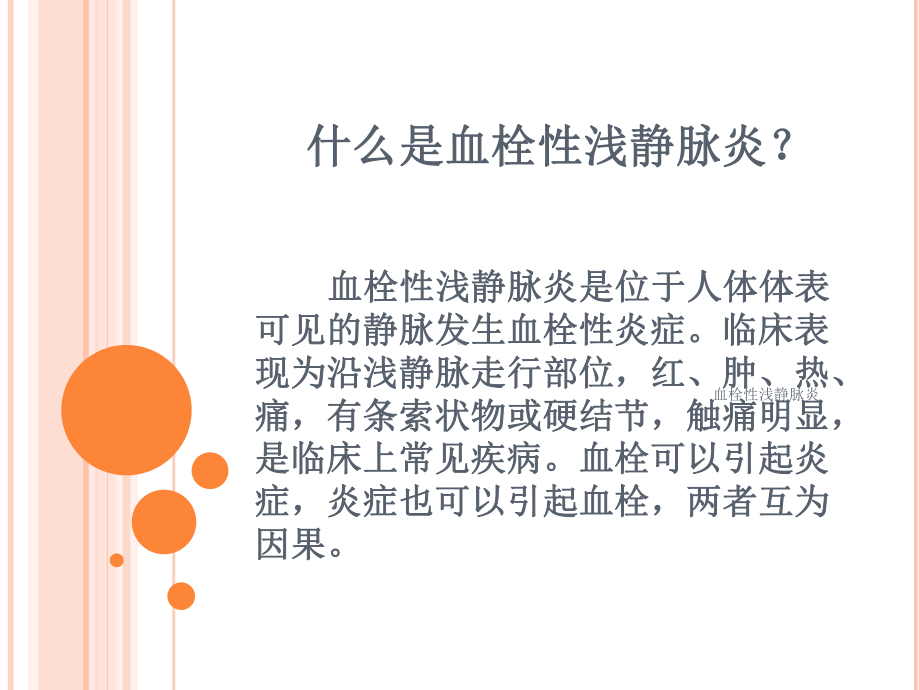 血栓性浅静脉炎培训课件.ppt_第2页