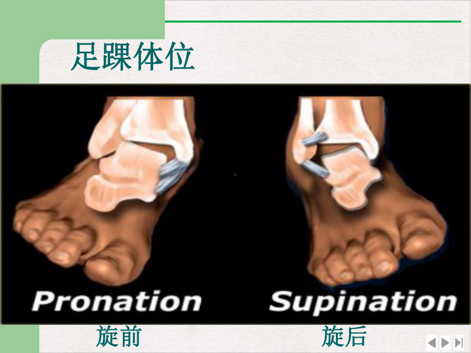 踝关节骨折与脱位的诊治完美课课件.pptx_第2页