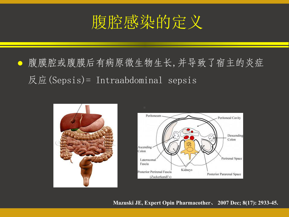 腹腔感染的治疗-课件.pptx_第3页