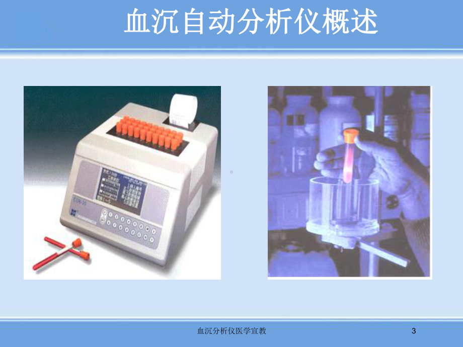 血沉分析仪医学宣教培训课件.ppt_第3页