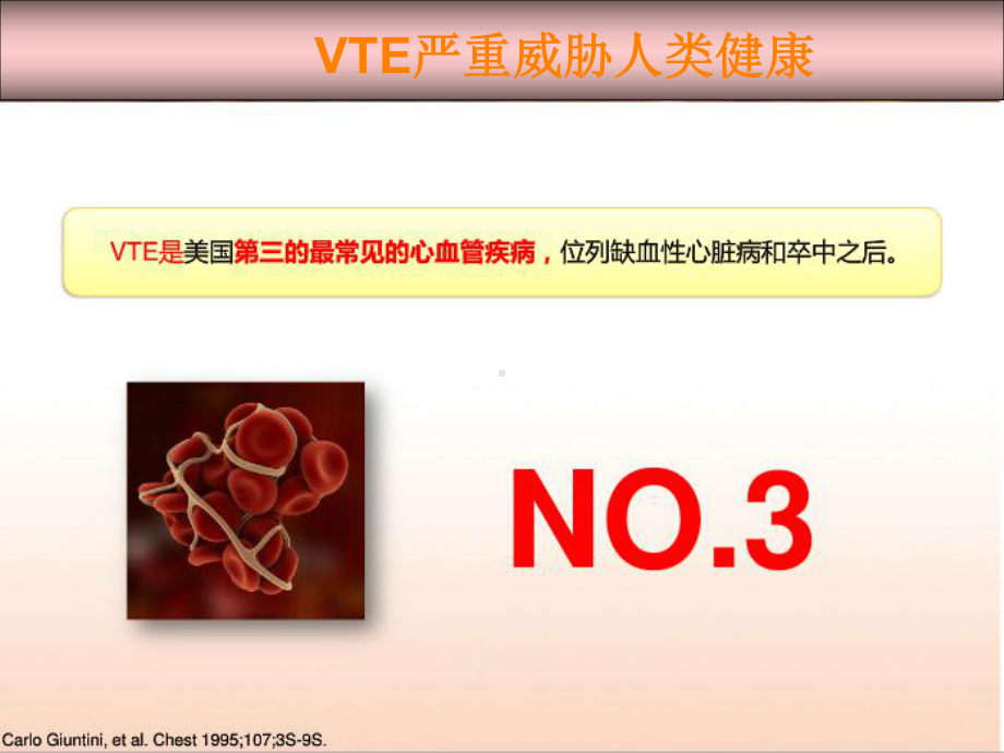 静脉血栓栓塞症的防治与建议课件.pptx_第2页