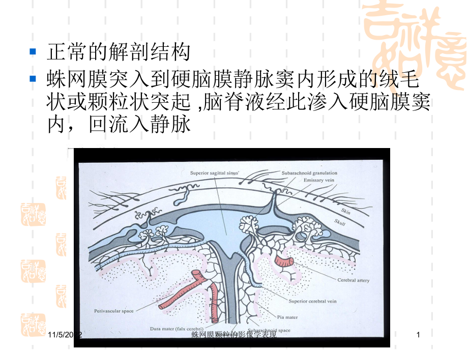 蛛网膜颗粒的影像学表现培训课件.ppt_第1页