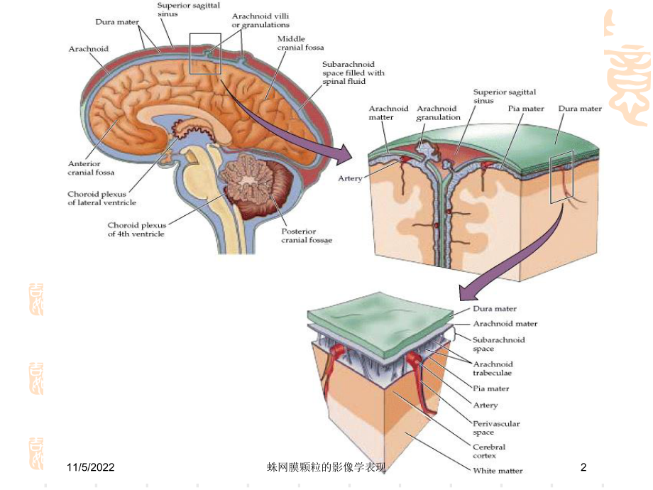 蛛网膜颗粒的影像学表现培训课件.ppt_第2页