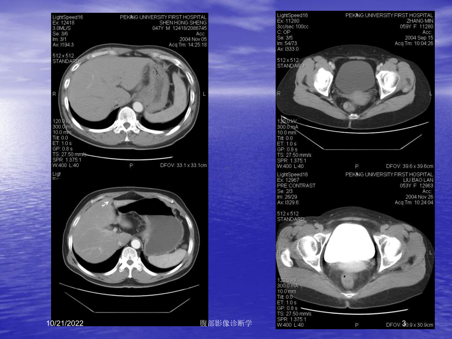 腹部影像诊断学培训课件.ppt_第3页