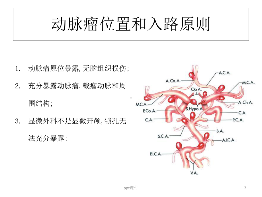 颅内动脉瘤手术入路-课件.ppt_第2页