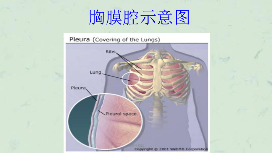 胸膜疾病版课件.ppt_第2页