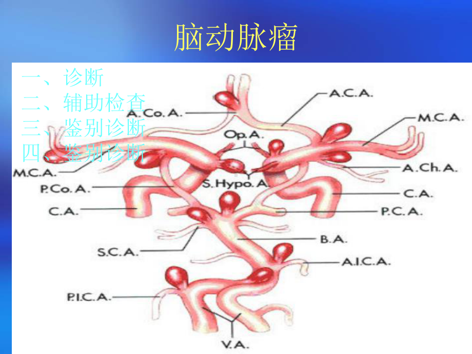 脑动脉瘤鉴别诊断课件.ppt_第2页