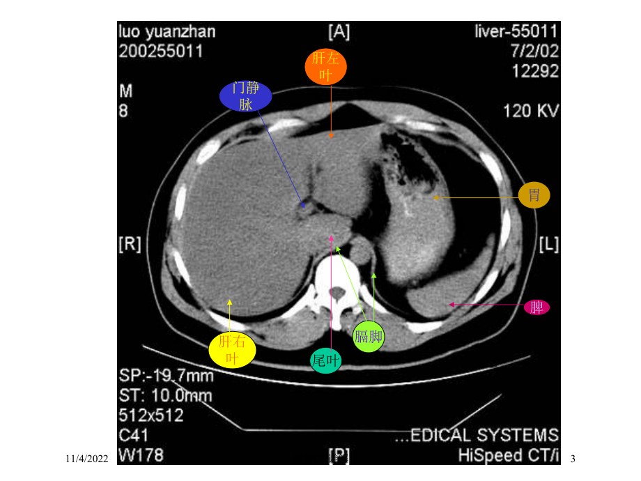 腹部CT详解培训课件.ppt_第3页