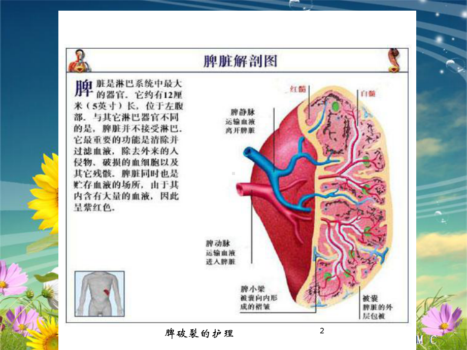 脾破裂的护理培训课件.ppt_第2页