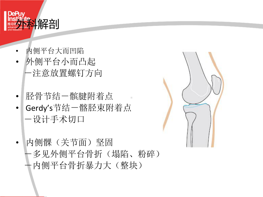 胫骨平台骨折的手术治疗课件.ppt_第2页